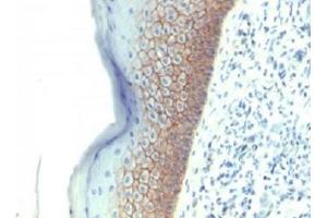 Formalin-fixed, paraffin-embedded human skin stained with E-Cadherin antibody (CDH1/1525).