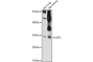 Western blot analysis of extracts of various cell lines, using UCP1 antibody  at 1:1000 dilution. (UCP1 Antikörper)