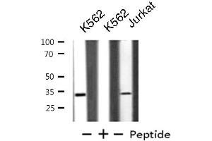 Western blot analysis of extracts from K562/Jurkat cells, using BTLA antibody. (BTLA Antikörper  (C-Term))