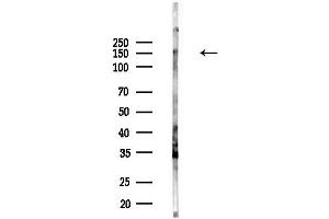 anti-Macrophage Stimulating 1 Receptor (C-Met-Related tyrosine Kinase) (MST1R) (C-Term) antibody