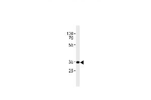 CB2 Antibody (C-term) (ABIN654631 and ABIN2844327) western blot analysis in A431 cell line lysates (35 μg/lane). (CNR2 Antikörper  (C-Term))