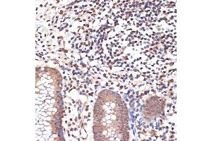 Immunohistochemistry of paraffin-embedded human appendix using K/MYST1/MOF Rabbit mAb (ABIN7268063) at dilution of 1:100 (40x lens). (MYST1 Antikörper)
