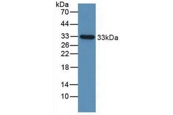 IGFBP2 anticorps  (AA 148-325)