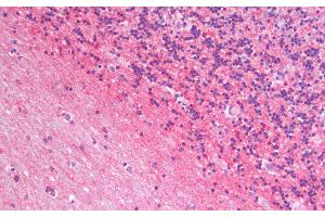 Immunohistochemistry analysis of paraffin-embedded Human Cerebellum using GAP43 Polyclonal Antibody. (GAP43 Antikörper)