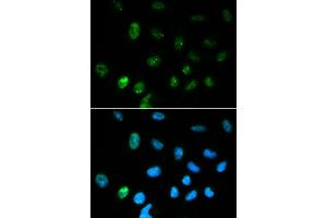 Immunofluorescence analysis of HepG2 cell using CGA antibody. (CGA Antikörper  (AA 25-116))