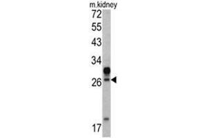 Western blot analysis of HOXA5 antibody (C-term E211) in mouse kidney tissue lysates (35ug/lane). (HOXA5 Antikörper  (C-Term))