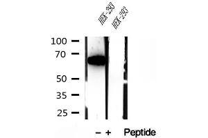 Western blot analysis of extracts of HEK-293 cells, using METTL3 antibody. (METTL3 Antikörper)