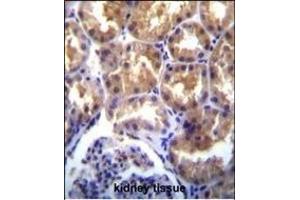 TR(CHAK2) Antibody (Center) (ABIN392616 and ABIN2842133) immunohistochemistry analysis in formalin fixed and paraffin embedded human kidney tissue followed by peroxidase conjugation of the secondary antibody and DAB staining. (TRPM6 Antikörper  (AA 317-348))