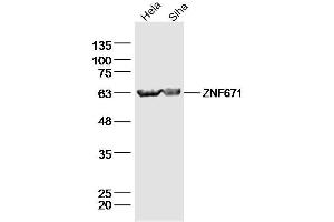 Lane 1: Hela lysates Lane 2: Siha lysates probed with ZNF671 Polyclonal Antibody, Unconjugated  at 1:300 dilution and 4˚C overnight incubation. (ZNF671 Antikörper  (AA 101-200))
