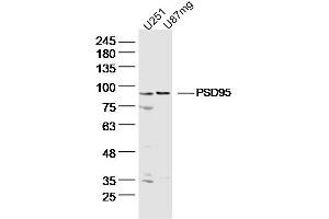 Lane 1: U251 lysates Lane 2: U87mg lysates probed with DLG4 Polyclonal Antibody, Unconjugated  at 1:300 dilution and 4˚C overnight incubation. (DLG4 Antikörper  (AA 351-450))