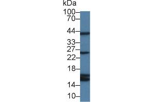 Detection of CYPA in Rat Serum using Polyclonal Antibody to Cyclophilin A (CYPA) (PPIA Antikörper  (AA 2-165))