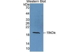 Detection of Recombinant CRABP2, Human using Polyclonal Antibody to Cellular Retinoic Acid Binding Protein 2 (CRABP2) (CRABP2 Antikörper  (AA 1-138))