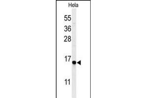 Western blot analysis of GABARL1 Antibody 9133a in Hela cell line lysates (35 μg/lane).