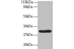 Western blot All lanes: GPR161 antibody at 2 μg/mL + EC109 whole cell lysate Secondary Goat polyclonal to rabbit IgG at 1/15000 dilution Predicted band size: 59, 46, 44, 50, 47, 61 kDa Observed band size: 30 kDa (GPR161 Antikörper  (AA 1-28))