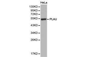 Western Blotting (WB) image for anti-Plasminogen Activator, Urokinase (PLAU) antibody (ABIN1874158) (PLAU Antikörper)