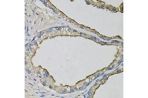 Immunohistochemistry of paraffin-embedded human prostate using LCN1 antibody (ABIN6003560) at dilution of 1/100 (40x lens). (Lipocalin 1 Antikörper)