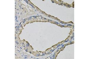 Immunohistochemistry of paraffin-embedded human prostate using LCN1 antibody (ABIN6003560) at dilution of 1/100 (40x lens).