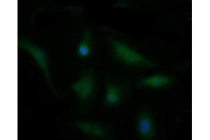 Image no. 4 for anti-Cell Division Cycle 123 Homolog (CDC123) antibody (ABIN1497389)