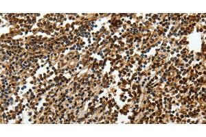 Immunohistochemistry of paraffin-embedded Human tonsil using SOX-13 Polyclonal Antibody at dilution of 1:50 (SOX13 Antikörper)