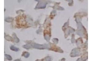 Immunohistochemistry (IHC) image for anti-Caspase 12 (Gene/pseudogene) (CASP12) (AA 95-318), (N-Term) antibody (ABIN567795) (Caspase 12 Antikörper  (N-Term))