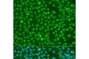 Immunofluorescence analysis of U2OS cells using Phospho-BRCA1(S1423) Polyclonal Antibody at dilution of 1:100. (BRCA1 Antikörper  (pSer1423))