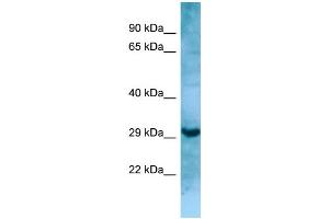 WB Suggested Anti-MASP1 Antibody Titration: 1. (MASP1 Antikörper  (N-Term))