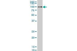 Western Blotting (WB) image for anti-Polymerase (DNA Directed) kappa (POLK) (AA 1-472) antibody (ABIN565606)