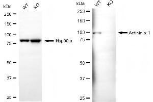 Western blotting analysis using actinin alpha 1 antibody (ABIN7797471). (Rekombinanter ACTN1 Antikörper)