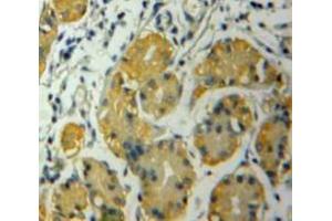 Used in DAB staining on fromalin fixed paraffin-embedded Stomach tissue (CSNK1A1 Antikörper  (AA 130-337))