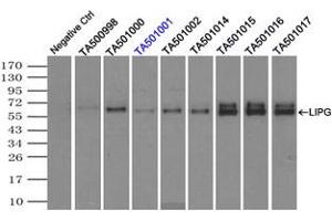 Image no. 4 for anti-Lipase, Endothelial (LIPG) antibody (ABIN1499177) (LIPG Antikörper)