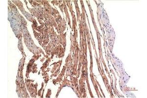 Immunohistochemical analysis of paraffin-embedded Rat Heart Tissue using VE-Cadherin Mouse mAb diluted at 1:200. (Cadherin 5 Antikörper  (AA 670-750))