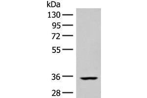 Western blot analysis of Human heart tissue lysate using FBXO16 Polyclonal Antibody at dilution of 1:400 (FBXO16 Antikörper)
