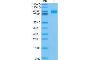 Human CD155 on Tris-Bis PAGE under reduced condition. (Poliovirus Receptor Protein (PVR) (AA 21-343) (Fc Tag))