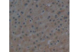 IHC-P analysis of Human Tissue, with DAB staining. (APOA1 Antikörper  (AA 122-267))