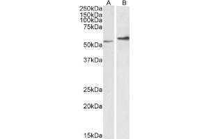 ABIN2613493 (0. (Vimentin Antikörper  (C-Term))