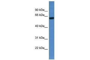 Western Blot showing TCHP antibody used at a concentration of 1-2 ug/ml to detect its target protein. (TCHP Antikörper  (C-Term))