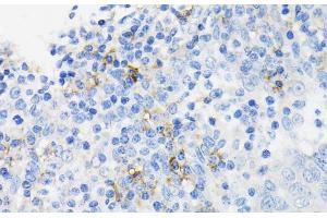 Immunohistochemistry of paraffin-embedded Human tonsil using CAMP Polyclonal Antibody at dilution of 1:200 (40x lens). (Cathelicidin Antikörper)