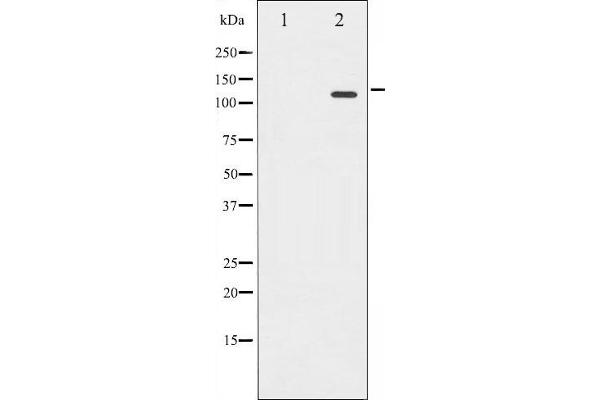 Retinoblastoma 1 Antikörper  (pSer780)
