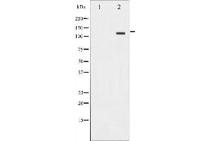 Western blot analysis of Retinoblastoma phosphorylation expression in serum treated K562 whole cell lysates,The lane on the left is treated with the antigen-specific peptide.