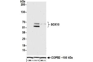 Western Blotting (WB) image for anti-SRY (Sex Determining Region Y)-Box 10 (SOX10) (AA 416-466) antibody (ABIN7455186)