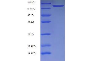 SDS-PAGE (SDS) image for RNA Binding Motif Protein, Y-Linked, Family 1, Member F (RBMY1F) (AA 1-496), (full length) protein (His-SUMO Tag) (ABIN5711263) (RBMY1F Protein (AA 1-496, full length) (His-SUMO Tag))