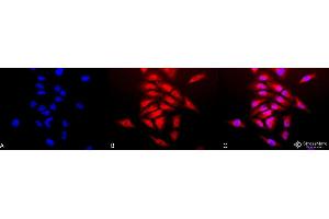 Immunocytochemistry/Immunofluorescence analysis using Rabbit Anti-SOD (Cu/Zn) Polyclonal Antibody . (SOD1 Antikörper  (PerCP))