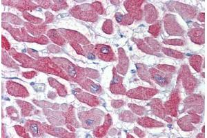 Heart, Human: Formalin-Fixed, Paraffin-Embedded (FFPE) (CRYAB Antikörper)
