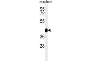 Western Blotting (WB) image for anti-Tektin 4 (TEKT4) antibody (ABIN3002227) (Tektin 4 Antikörper)