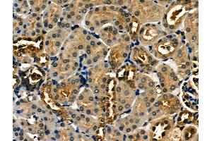 ABIN6262631 and ABIN6266566 at 1/100 staining Mouse kidney tissue by IHC-P.