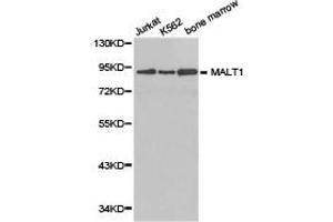 Western Blotting (WB) image for anti-Mucosa Associated Lymphoid Tissue Lymphoma Translocation Gene 1 (MALT1) antibody (ABIN1873591) (MALT1 Antikörper)