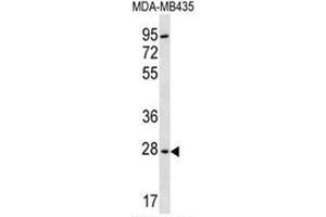 BPGM Antibody (C-term) western blot analysis in MDA-MB435 cell line lysates (35µg/lane). (BPGM Antikörper  (C-Term))