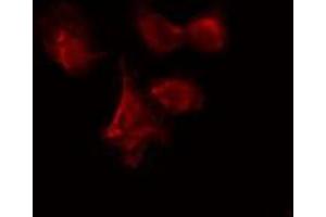 ABIN6274085 staining Hela cells by IF/ICC. (CDC7 Antikörper  (N-Term))