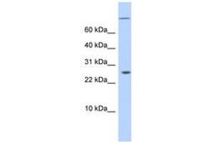 Image no. 1 for anti-AT Rich Interactive Domain 5A (MRF1-Like) (ARID5A) (N-Term) antibody (ABIN6743583) (ARID5A Antikörper  (N-Term))