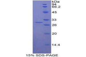 SDS-PAGE analysis of Human Mindbomb Homolog 2 Protein.